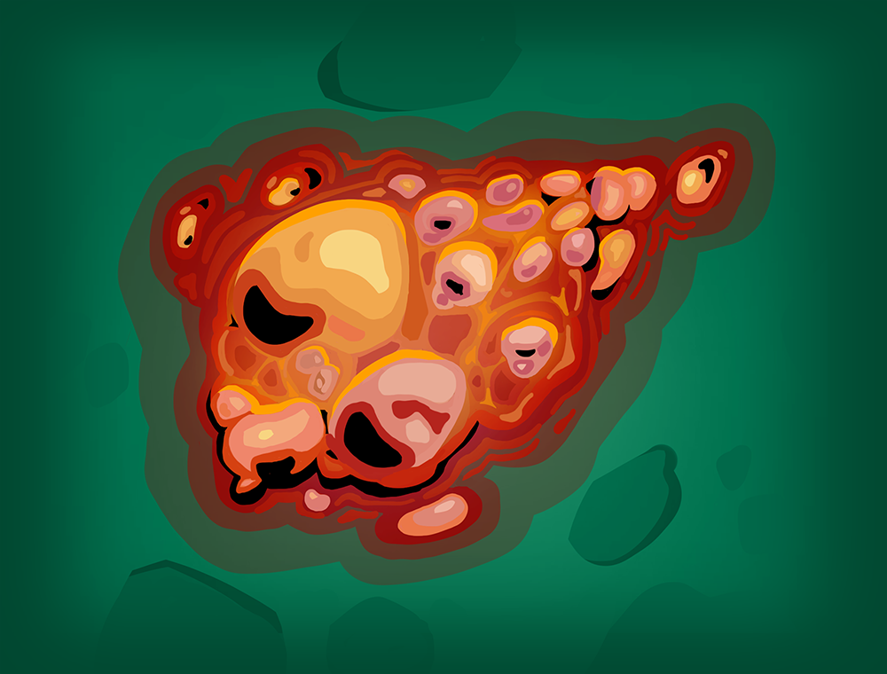 Burn card image